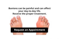 Are Bunions Affecting Your Everyday Life?