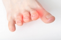 Surgery May Be Necessary to Treat Morton’s Neuroma