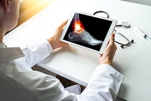 Possible Complications of Ankle Fractures